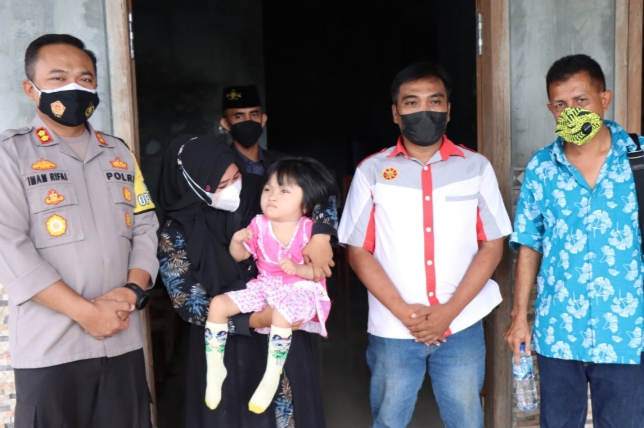 Dua Penderita Hydrocephalus di Situbondo, Dapat Bantuan Pengobatan dari Kapolres